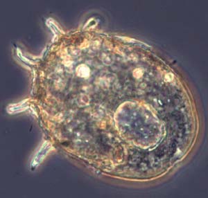 Centropyxis_aculeata.jpg