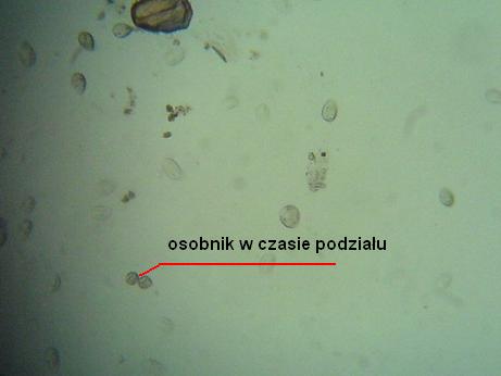 chilodeonella 1.JPG